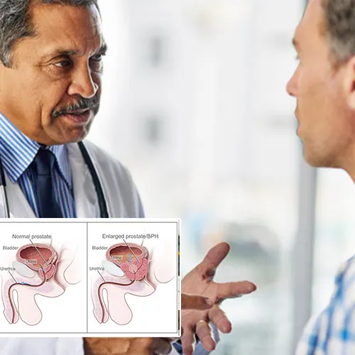 Simplifying the Complex: Your Penile Implant Surgery Questions Answered