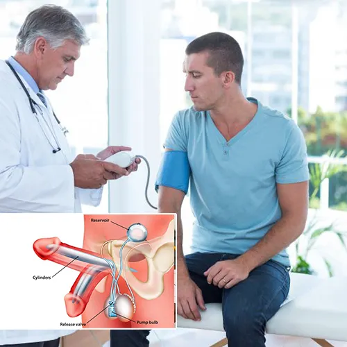 Welcome to  High Pointe Surgery Center 
: Understanding Penile Implant Longevity and Performance